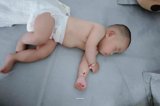 兰州六个月宝宝眼睛散光